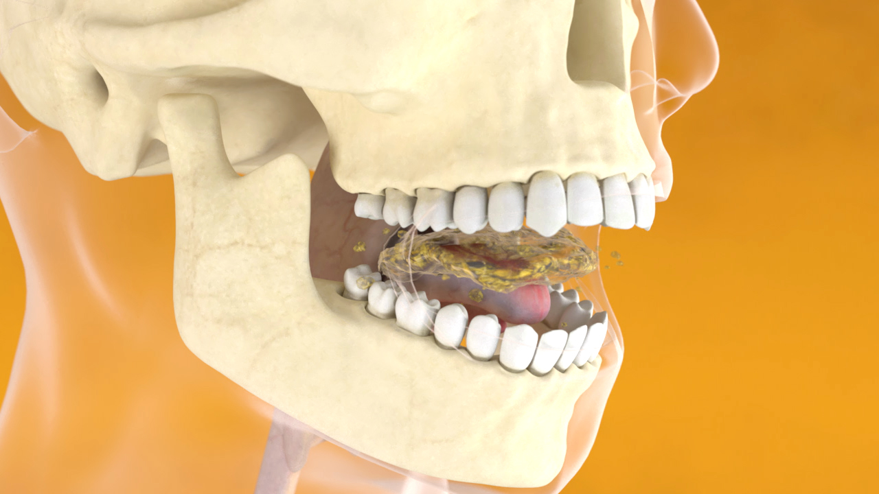 3D-Darstellung eines menschlichen Schädels mit geöffnetem Mund, zeigt Zähne und Kieferstruktur.