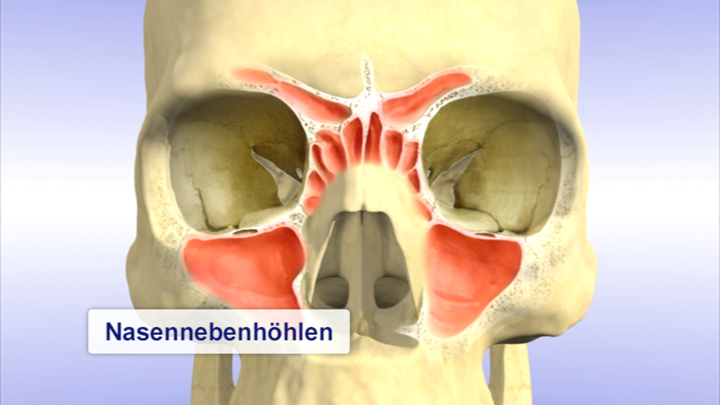 3D-Darstellung des menschlichen Schädels mit hervorgehobenen Nasennebenhöhlen.