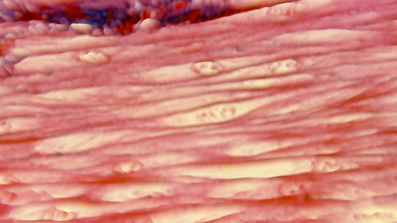 Mikroskopische Ansicht von Eingeweidemuskelgewebe.