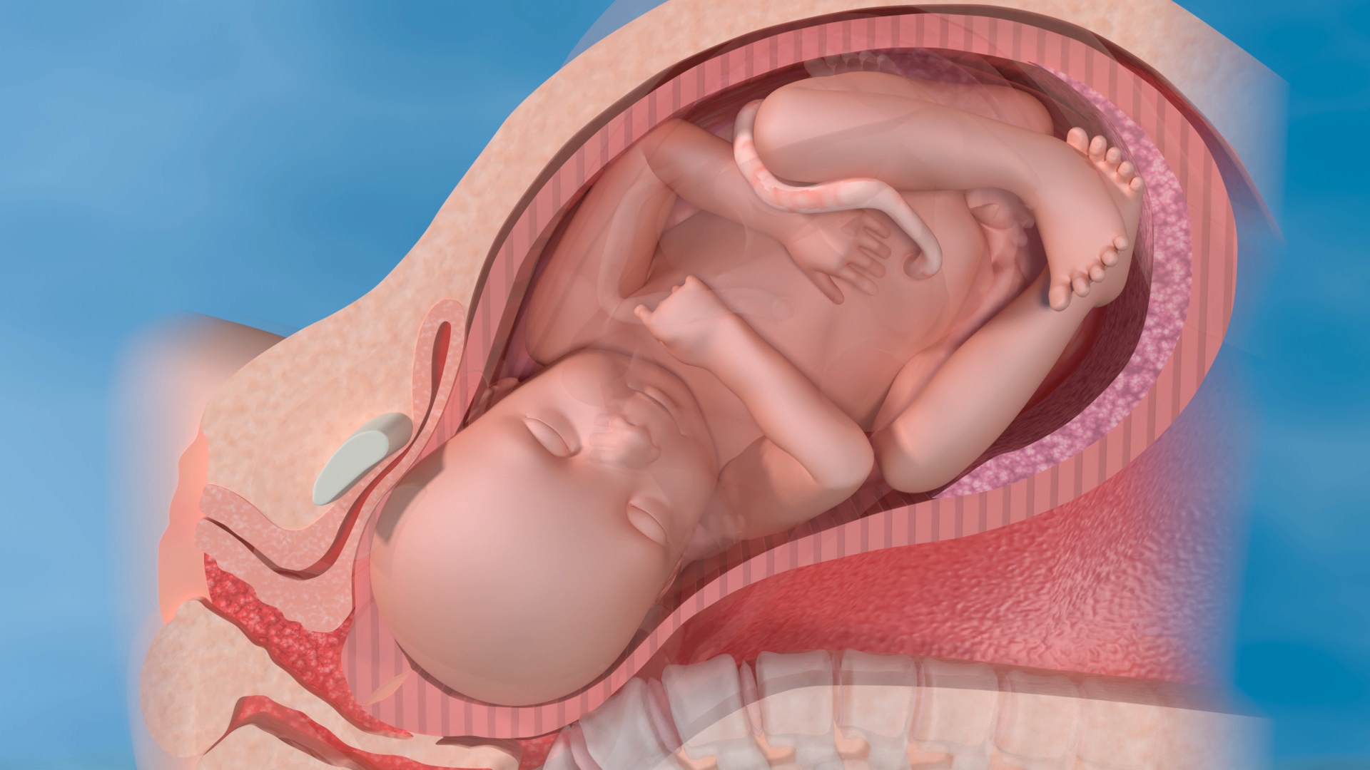 Darstellung eines Fötus im Mutterleib, in einer typischen Position kurz vor der Geburt.