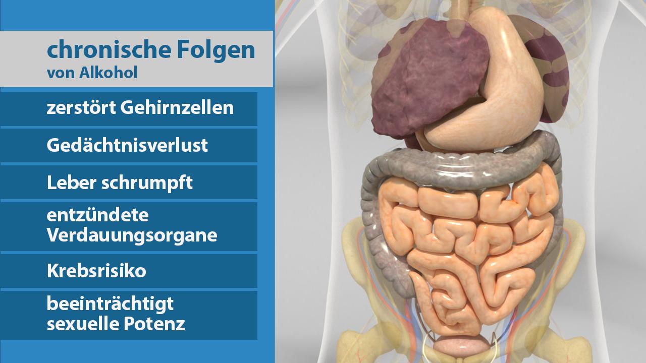 Grafik zeigt die chronischen Folgen von Alkohol, einschließlich zerstörter Gehirnzellen, Gedächtnisverlust, geschrumpfter Leber, entzündeter Verdauungsorgane, erhöhtem Krebsrisiko und beeinträchtigter sexueller Potenz.