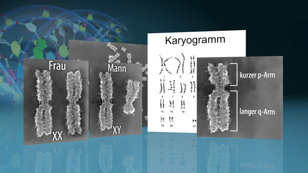 Darstellung von Chromosomen mit Karyogramm, zeigt Unterschiede zwischen XX (Frau) und XY (Mann) Chromosomen.