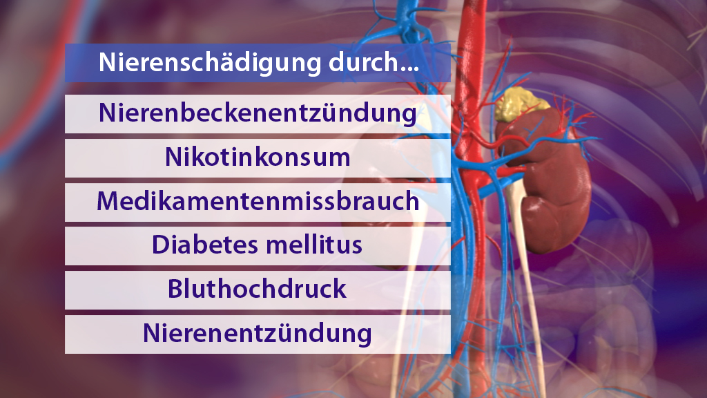 Liste von Ursachen für Nierenschädigung: Nierenbeckenentzündung, Nikotinkonsum, Medikamentenmissbrauch, Diabetes mellitus, Bluthochdruck, Nierenentzündung.
