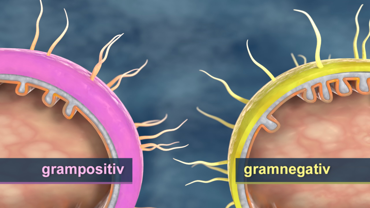 Diagramm, das den Unterschied zwischen grampositiven (pink) und gramnegativen (gelb) Bakterien zeigt, mit Zellwandstrukturen.
