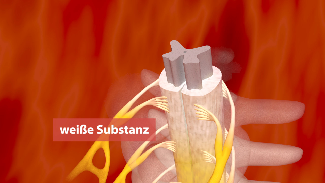 3D-Darstellung eines Nervs mit weißer Substanz, umgeben von gelben Nervenfasern und rotem Hintergrund.