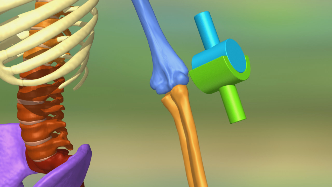 3D-Darstellung eines menschlichen Gelenks mit Knochen und einer farbigen Verbindungselement.
