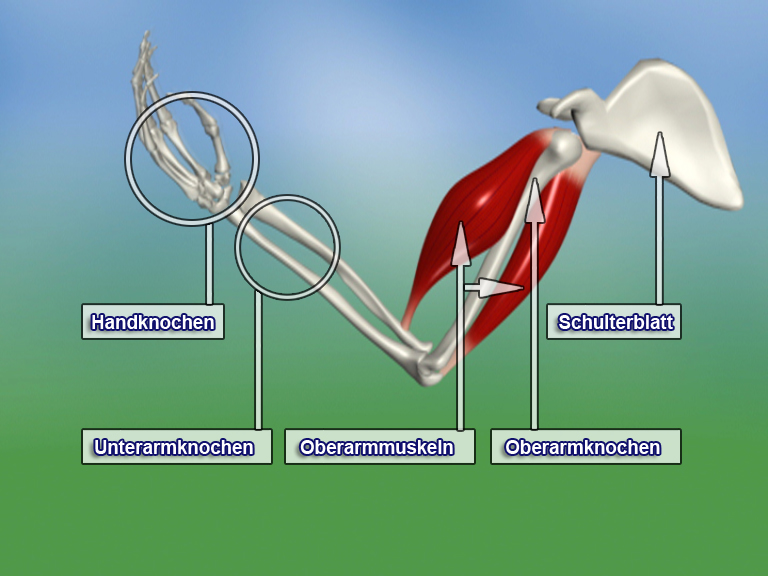 Diagramm des menschlichen Arms mit Beschriftungen für Handknochen, Unterarmknochen, Oberarmknochen und Schulterblatt.