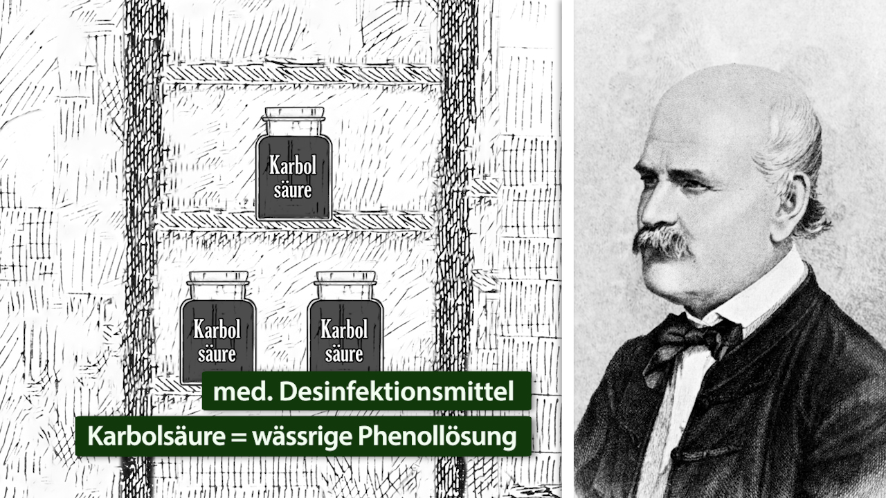 Illustration von Desinfektionsmitteln mit der Aufschrift 'Karbolsäure' und einem Porträt eines Mannes im Anzug.