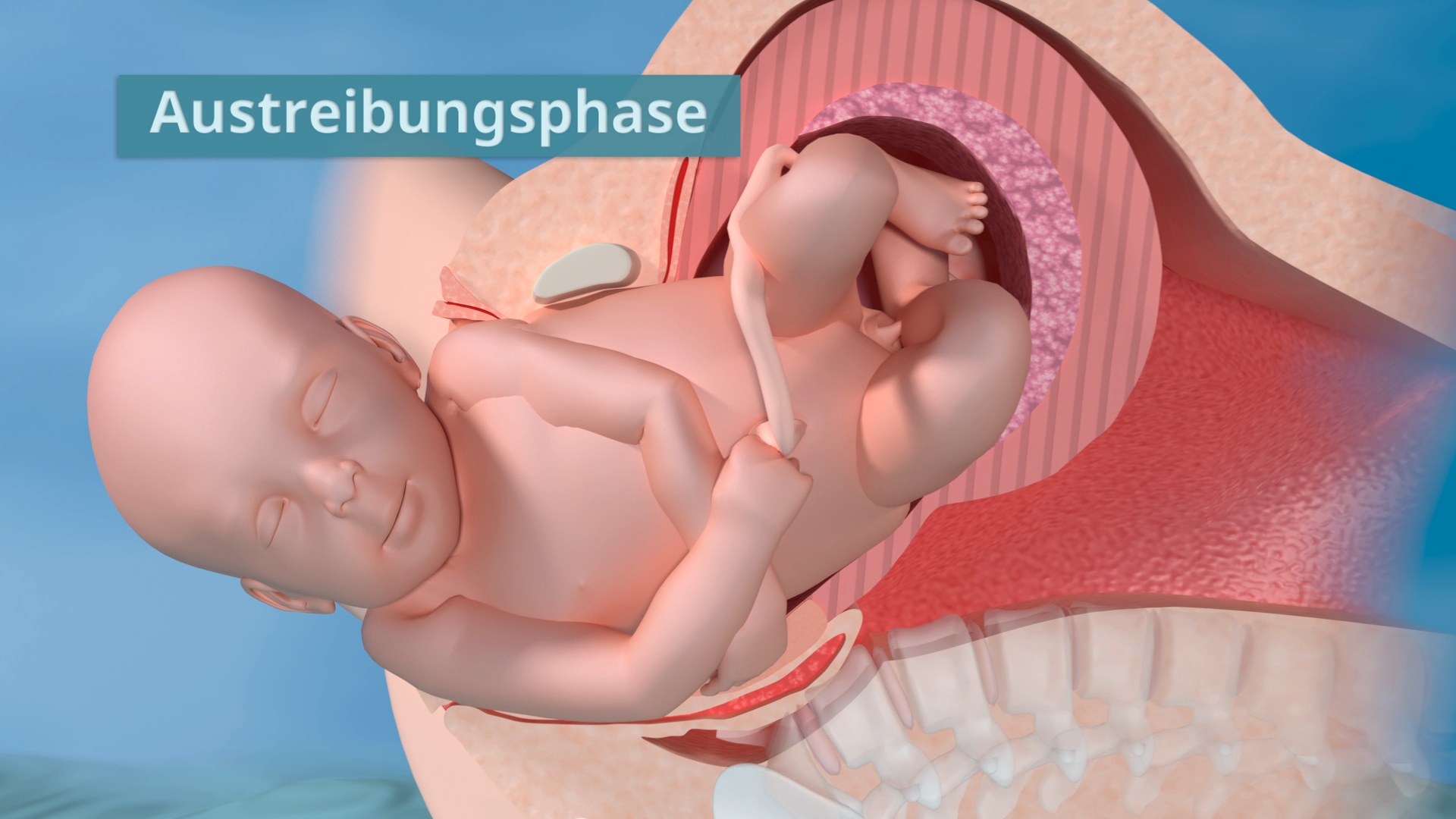 3D-Darstellung der Austreibungsphase während der Geburt, zeigt das Baby, das durch den Geburtskanal kommt.