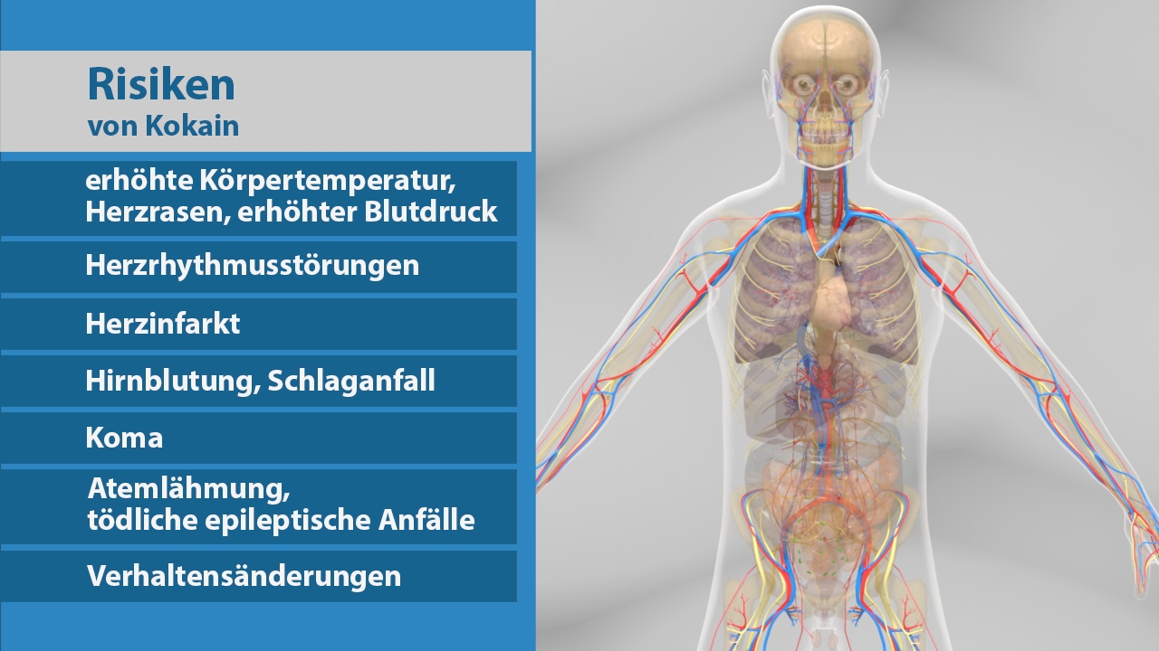 Infografik über die Risiken von Kokain, einschließlich erhöhter Körpertemperatur, Herzrasen, Herzrhythmusstörungen, Herzinfarkt, Hirnblutung, Koma, Atemlähmung und Verhaltensänderungen.