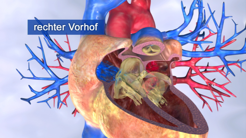 3D-Darstellung des menschlichen Herzens mit Fokus auf den rechten Vorhof und den Blutgefäßen.