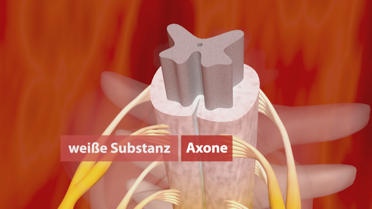 3D-Darstellung eines Axons in der weißen Substanz des Nervensystems, umgeben von Nervenfasern.