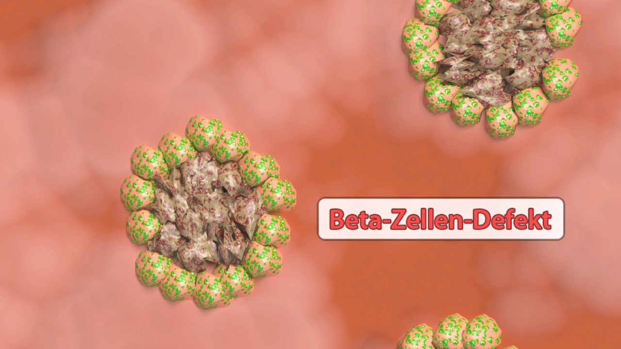 Grafik, die Beta-Zellen-Defekte in einem zellulären Kontext darstellt, mit hervorgehobenen Zellen.