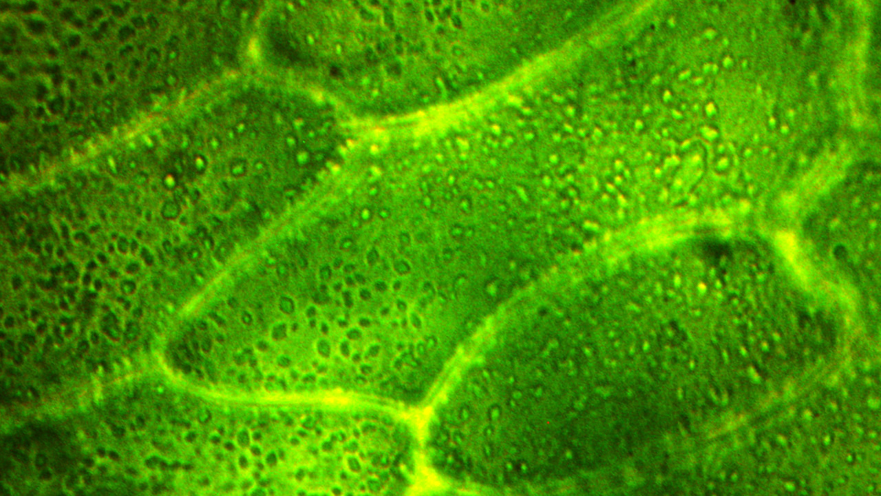 Mikroskopische Aufnahme von grünen Chloroplasten in Pflanzenzellen.