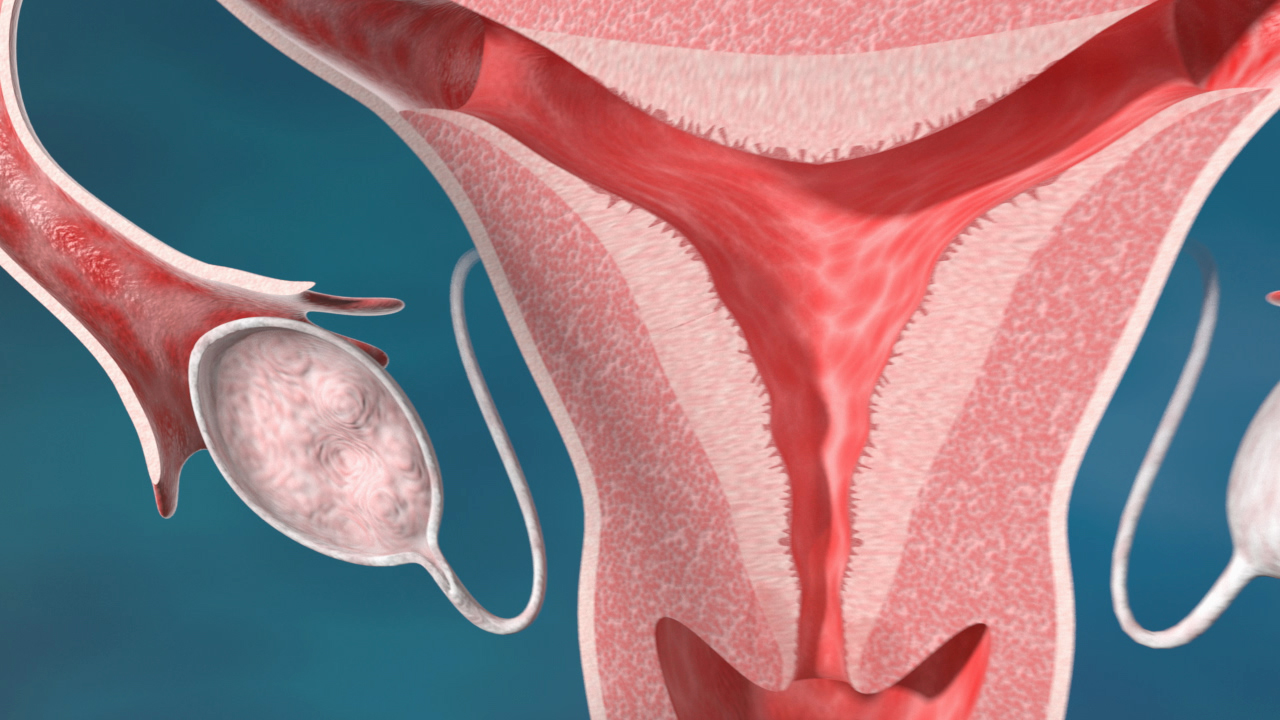 Anatomische Darstellung des weiblichen Fortpflanzungssystems, einschließlich Gebärmutter, Eileiter und Eierstöcke.