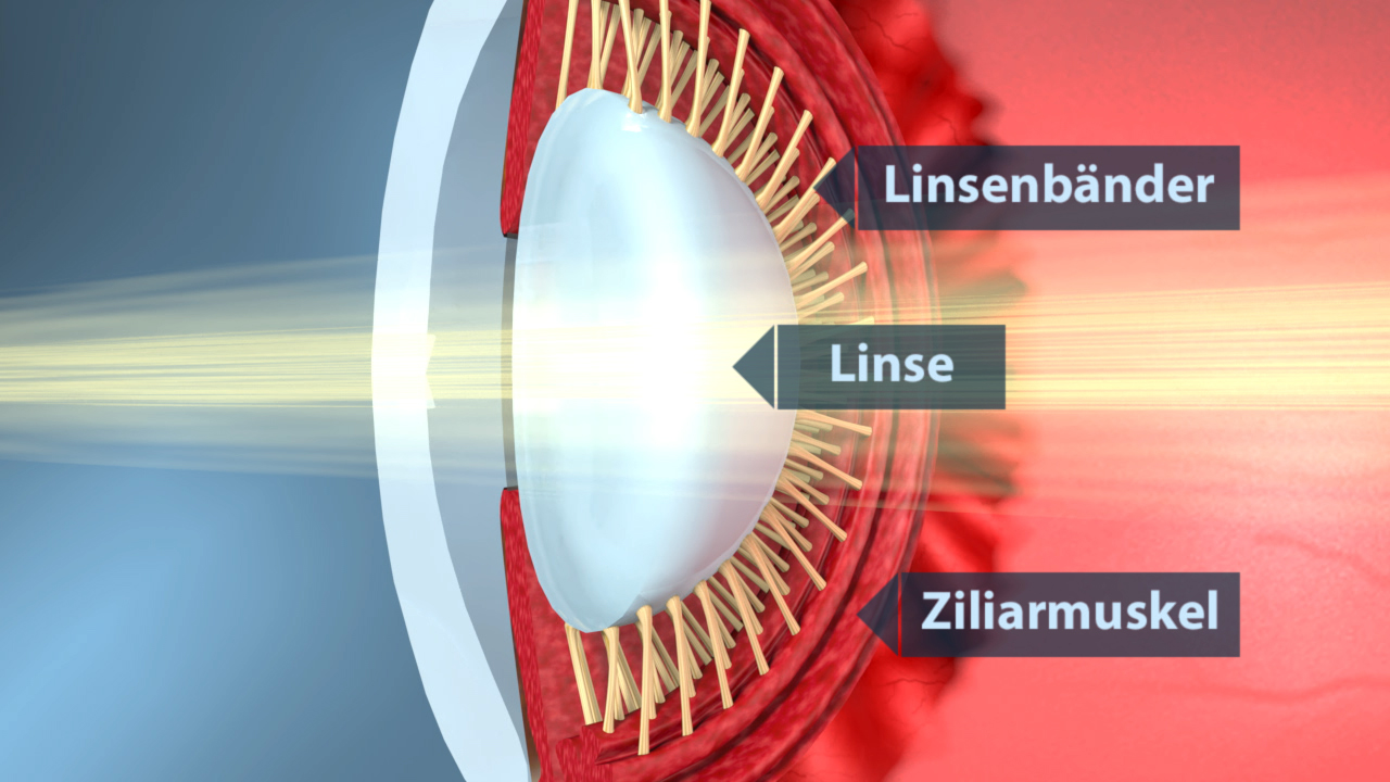 Diagramm des menschlichen Auges mit Beschriftungen für Linse, Linsenbänder und Ziliarmuskel.