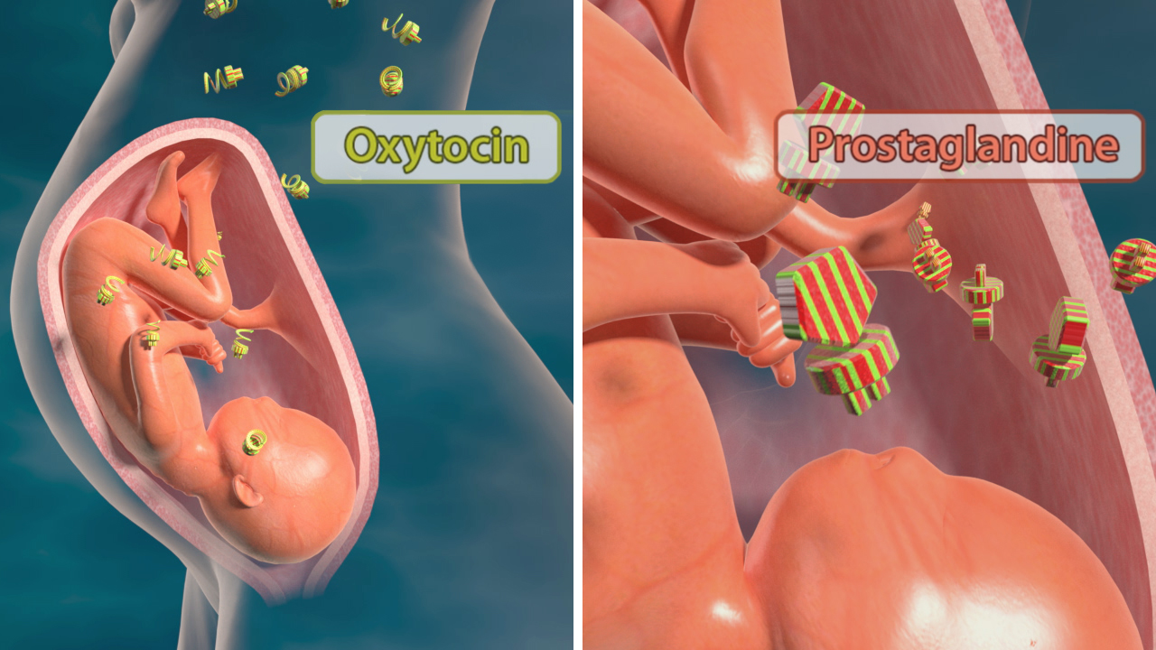 Animation zeigt die Wirkung von Oxytocin und Prostaglandinen während der Geburt.