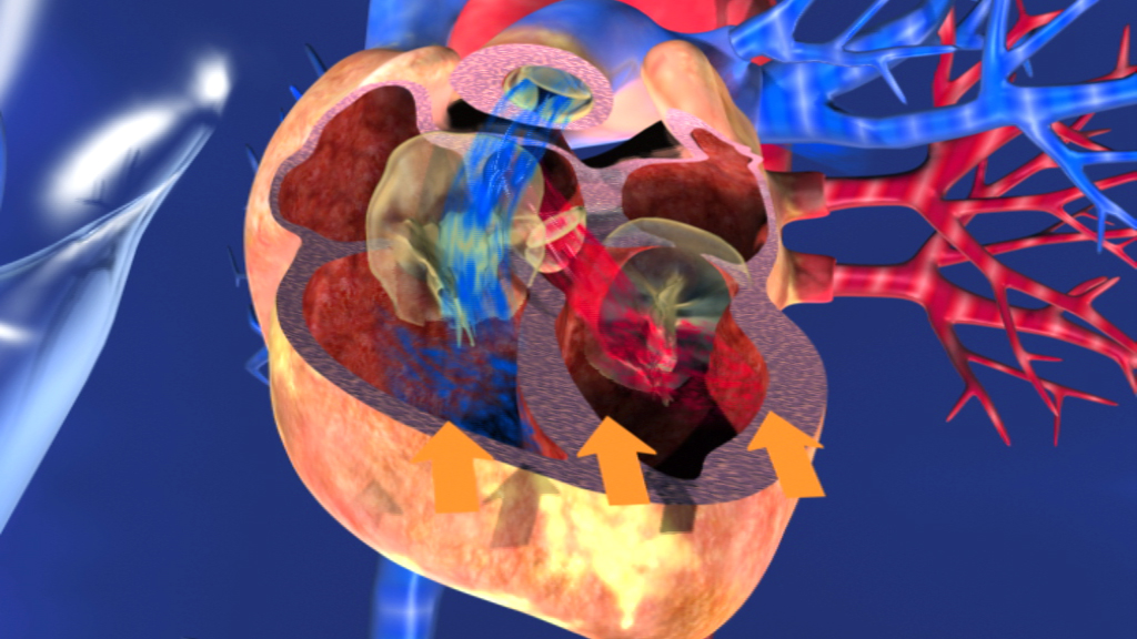 3D-Darstellung eines Herzens mit sichtbaren Kammern und Blutflussrichtungen.