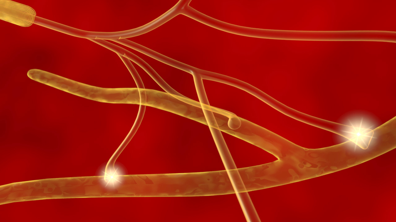 Grafik von Nervenfasern in einem roten Hintergrund, die elektrische Impulse übertragen.