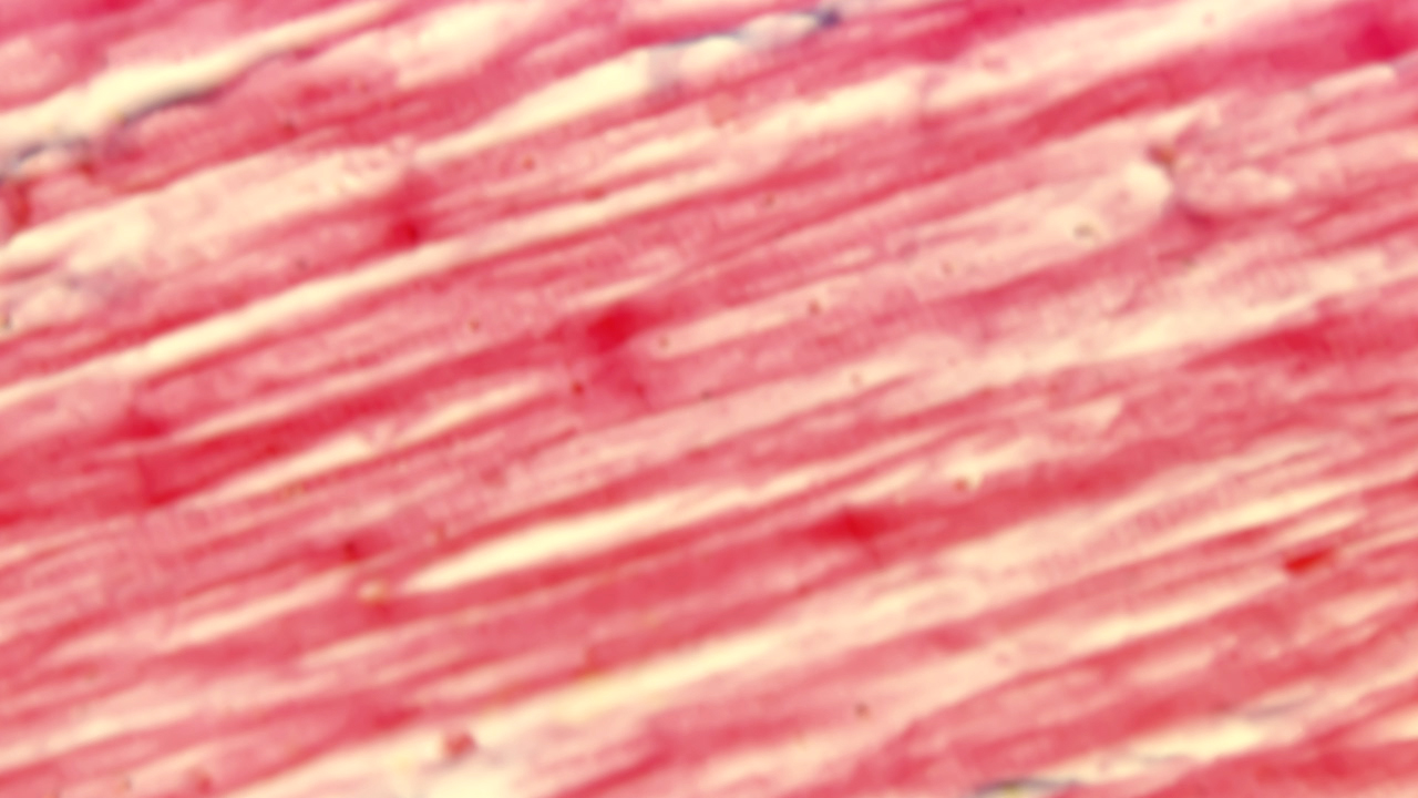 Mikroskopische Ansicht von Muskelgewebe mit rot-weißen Streifen.