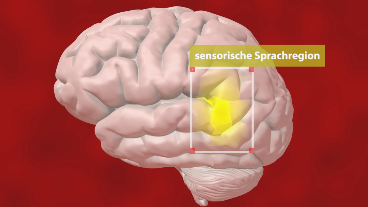 Grafik eines menschlichen Gehirns mit hervorgehobener sensorischer Sprachregion in Gelb.