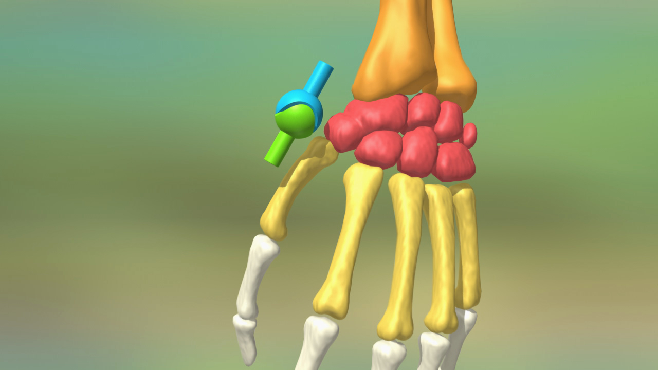 3D-Darstellung eines menschlichen Handgelenks mit Knochen und Gelenken in verschiedenen Farben.
