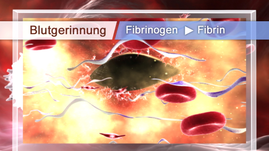 Visualisierung des Blutgerinnungsprozesses, Fibrinogen wird zu Fibrin umgewandelt, rote Blutkörperchen sind sichtbar.