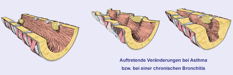 Feinbau der Bronchien